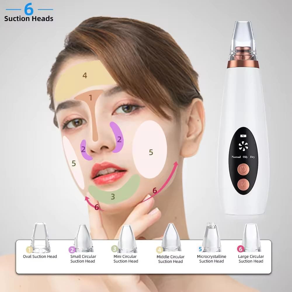 6-in-1 Blackhead Remover