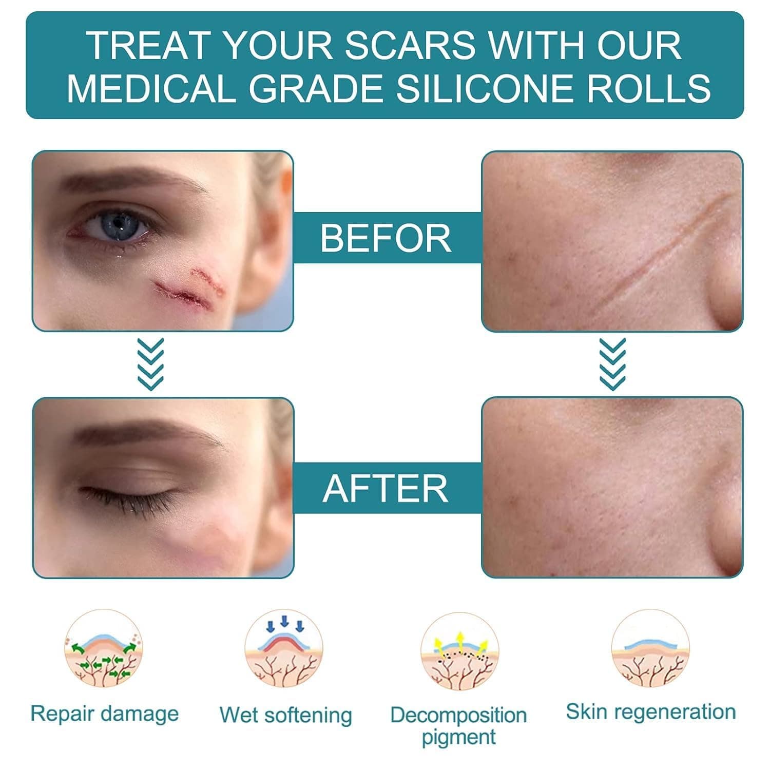 Scar Removal Sheet